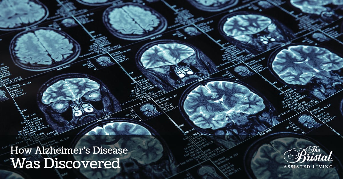 How Alzheimer's Disease Was Discovered, brain scans, the Bristal logo