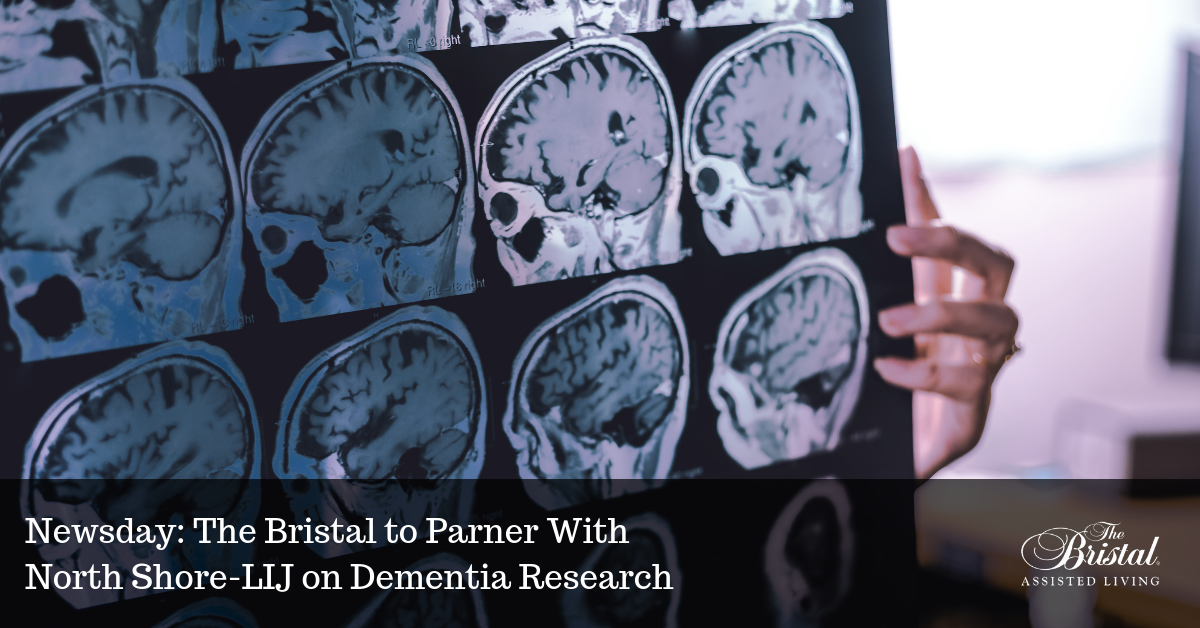 research proposal on dementia
